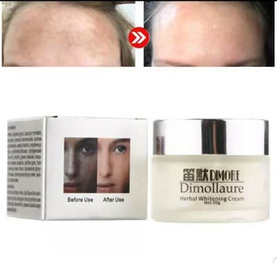 קרם להסרת כתמי פיגמנטציה ולהבהרת העור