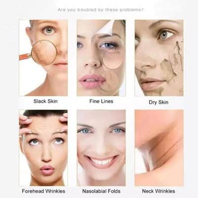 מארז לפנים זוהרות