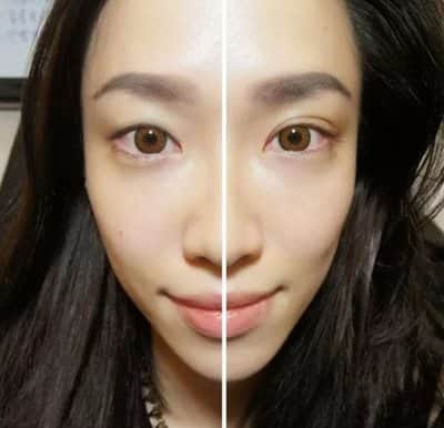 סרום להרמת עפעפיים-Eyelid Serum